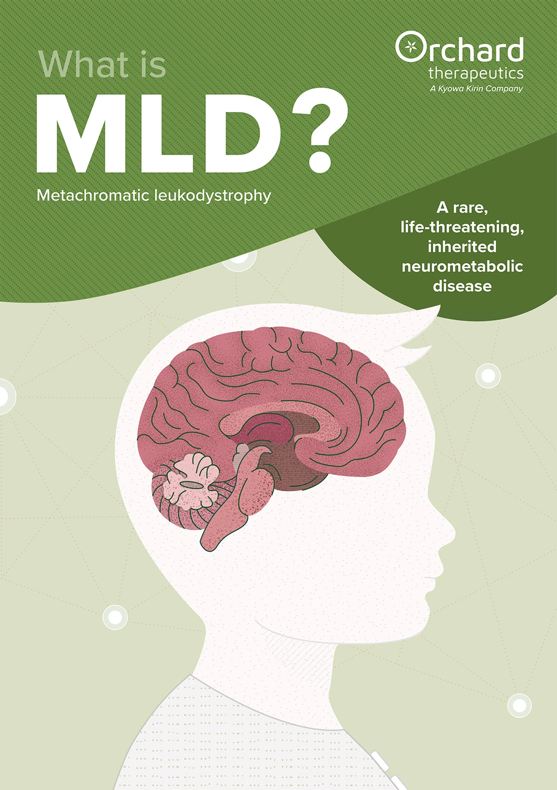 What is MLD?